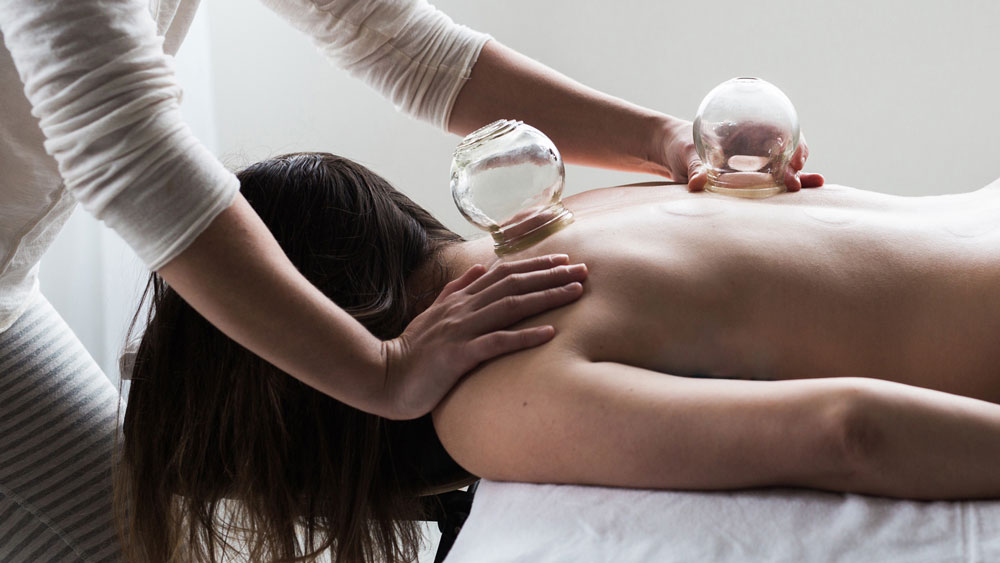 What is Cupping and What are the Benefits?